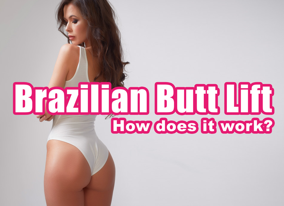 woman with Brazilian butt lift 