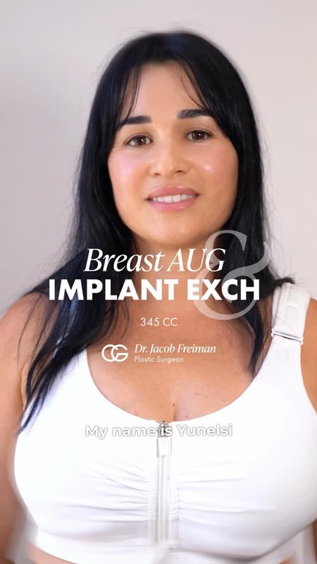 Breast Implant Exchange Review, What to Expect