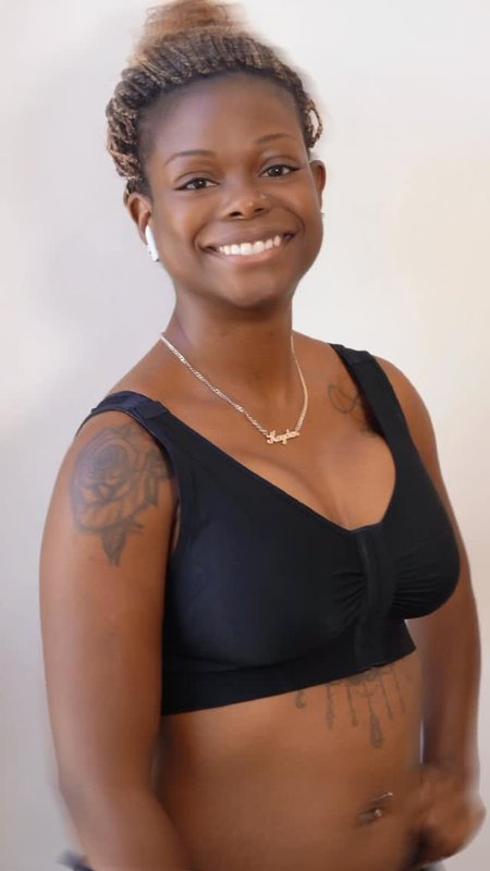 Breast Lift (Mastopexy) Journey, CG Cosmetic Patient