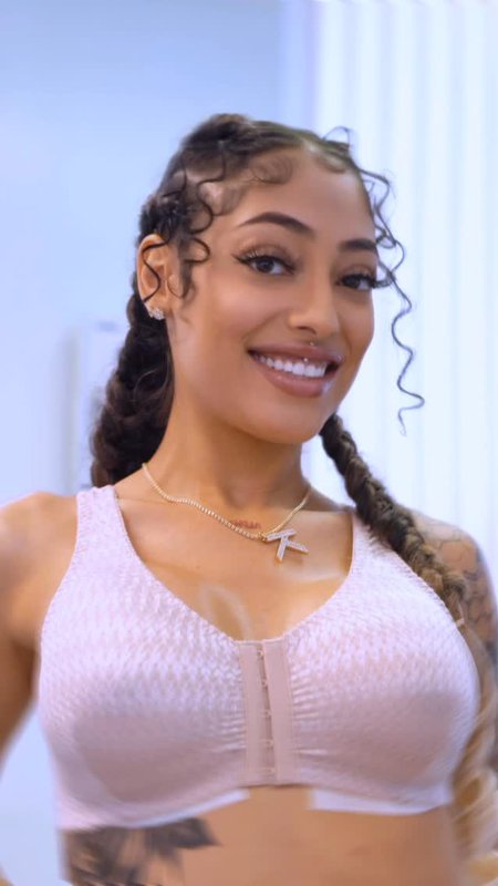 Patient Testimonial, Breast Augmentation at CG Cosmetic