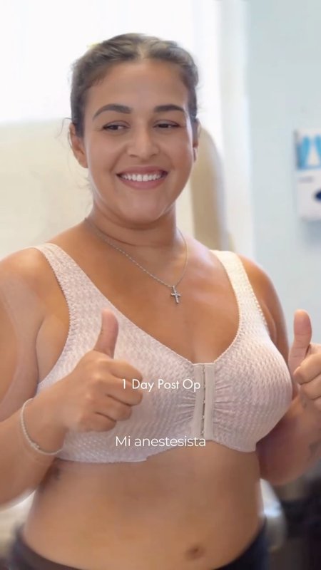 What Breast Lift (Mastopexy) Really Looks Like, Patient