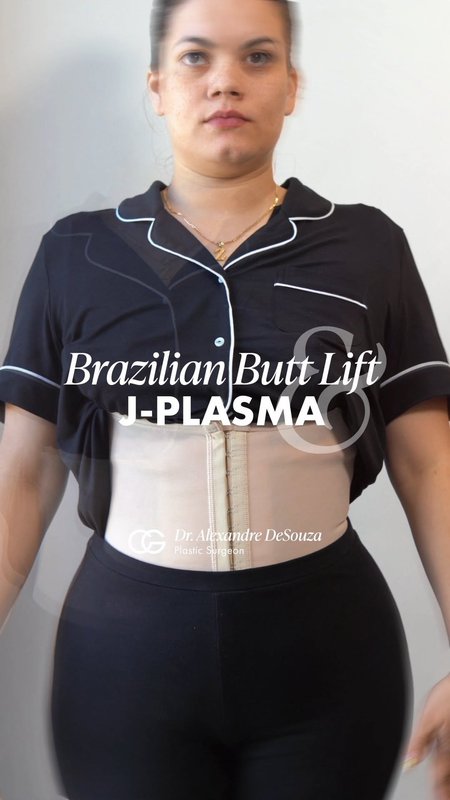 Inside Her Brazilian Butt Lift (BBL) Experience at CG C