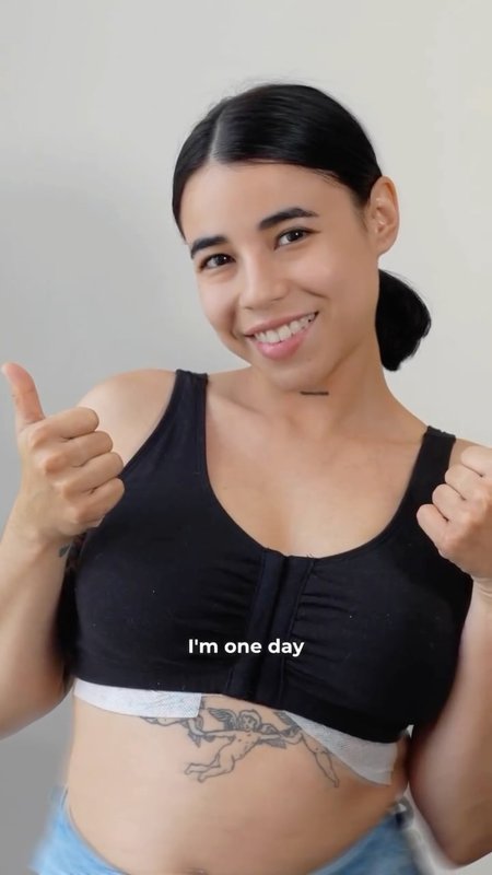 Real Story: Breast Augmentation in Miami