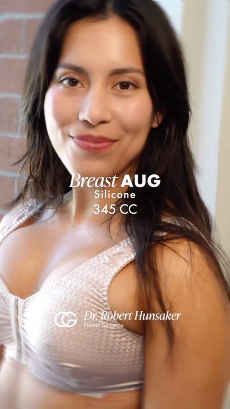 Patient Shares Her Breast Augmentation Results