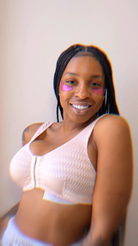 Breast Augmentation Success Story, Real Miami Patient