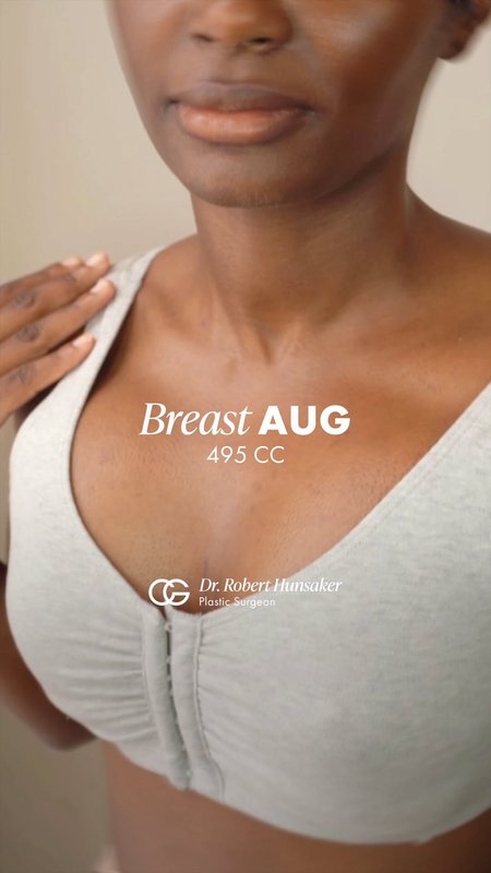 Breast Augmentation Results, Real Patient Experience