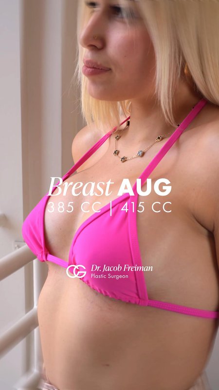 Breast Augmentation Testimonial, Miami Cosmetic Surgery