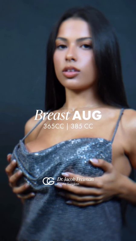 Breast Augmentation Transformation, Patient Testimonial