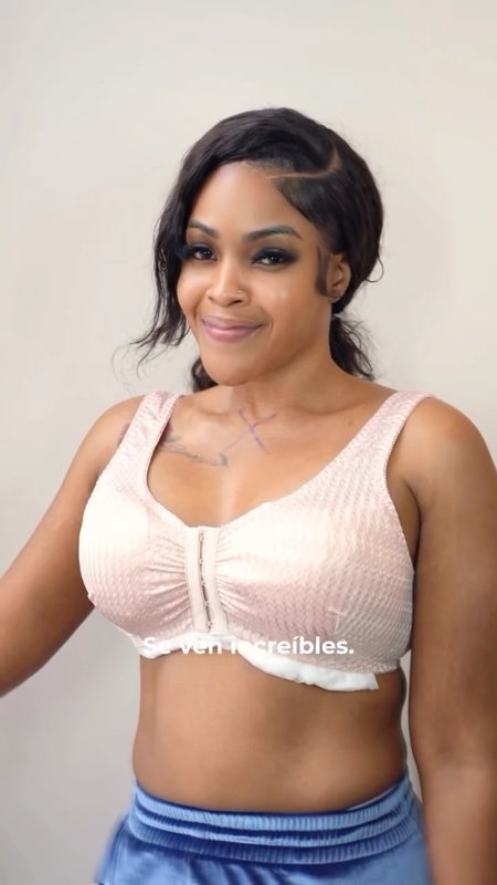 Breast Augmentation Journey, CG Cosmetic Patient