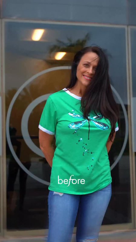 Before & After Story: Mommy Makeover Results