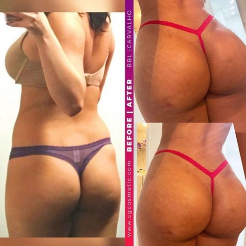 The beautiful ♥️ 🍑 shape !!! What do you think ...